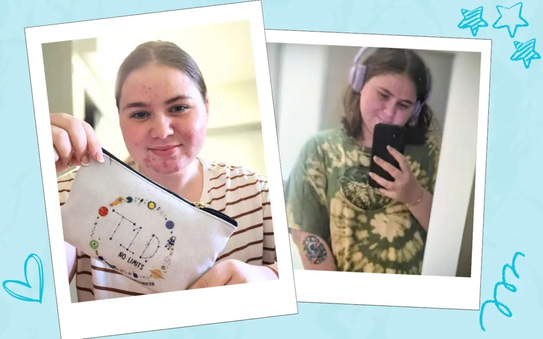 More Than Blood Sugar: Finding Balance with T1D